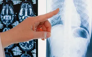 How to Make a Serious Injury Claim - Smith Partnership