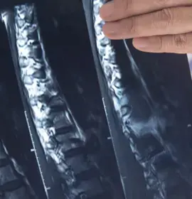 Spinal X-rays