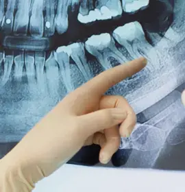 Dental X-ray