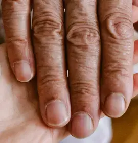 What is care home neglect