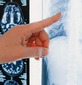 How to Make a Serious Injury Claim - Smith Partnership