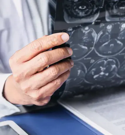 CT scans
