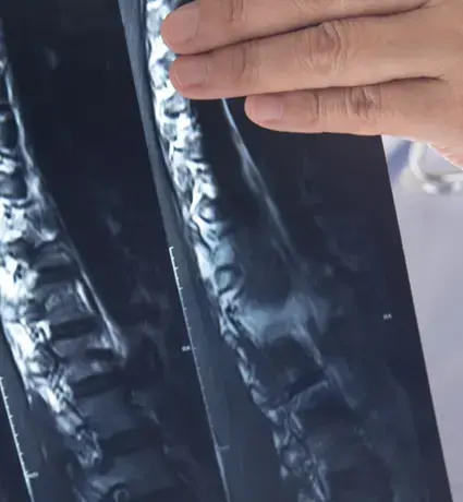 Spinal X-rays