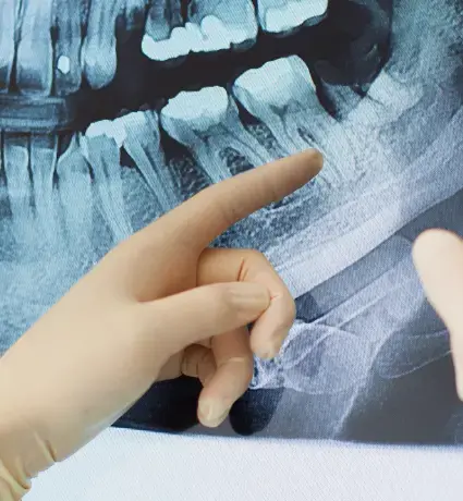 Dental X-ray