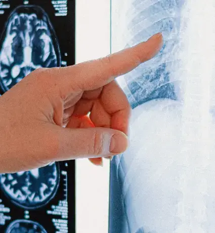 How to Make a Serious Injury Claim - Smith Partnership